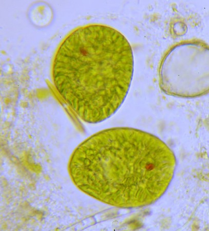 Amibes: être unicellulaire